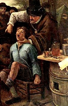 Tooth Puller